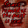 scars